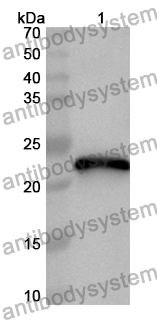 Anti-Human CHAC1 Polyclonal Antibody