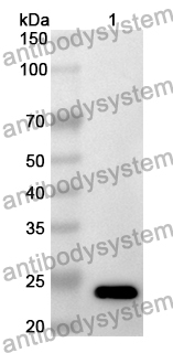 Anti-Human HCN2 Polyclonal Antibody