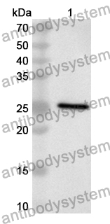 Anti-Human STARD7 Polyclonal Antibody