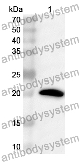 Anti-Human CHMP6 Polyclonal Antibody