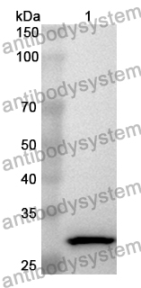 Anti-Human EXOSC8 Polyclonal Antibody