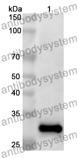 Anti-Human OSBPL2 Polyclonal Antibody