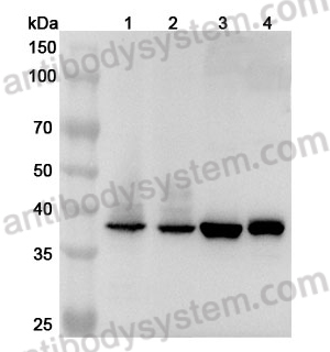 Anti-Human GDAP1 Polyclonal Antibody