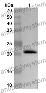 Anti-Human HPS6 Polyclonal Antibody