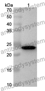 Anti-Human UNC13D Polyclonal Antibody