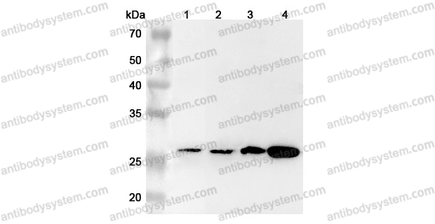 Anti-Human AGR3 Polyclonal Antibody