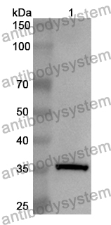 Anti-Human AKAP1 Polyclonal Antibody