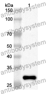 Anti-Human HBS1L Polyclonal Antibody