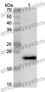 Anti-Human VPS33A Polyclonal Antibody