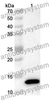 Anti-Human KIAA0586/TALPID3 Polyclonal Antibody