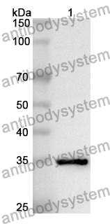 Anti-Human CTPS2 Polyclonal Antibody