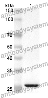 Anti-Human Pinin/PNN/DRSP Polyclonal Antibody