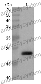 Anti-Human SLC27A3/FATP3 Polyclonal Antibody