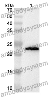 Anti-Human TMEM70 Polyclonal Antibody