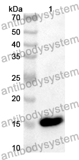 Anti-Human AMOTL2/LCCP Polyclonal Antibody