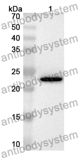 Anti-Human MRPL24 Polyclonal Antibody