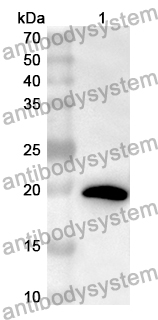 Anti-Human ORAI2 Polyclonal Antibody