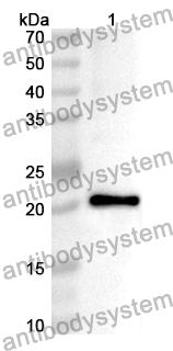 Anti-Human PHOX2B Polyclonal Antibody