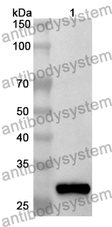 Anti-Human ANKRD6 Polyclonal Antibody