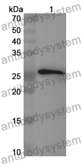 Anti-Human SALL4 Polyclonal Antibody