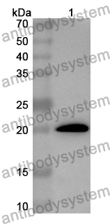 Anti-Human CBLL1 Polyclonal Antibody