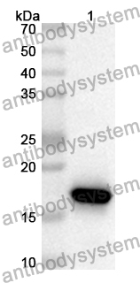 Anti-Human CEP135 Polyclonal Antibody