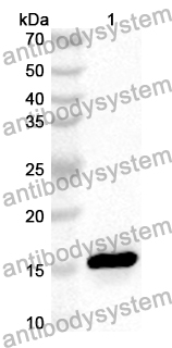 Anti-Human ADAMTSL4 Polyclonal Antibody