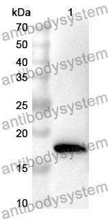 Anti-Human DZIP1 Polyclonal Antibody