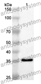 Anti-Human SLC2A9 Polyclonal Antibody