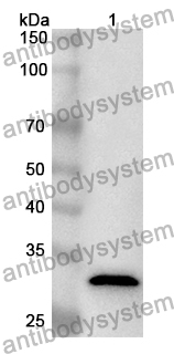 Anti-Human SLC25A46 Polyclonal Antibody