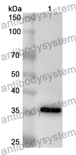 Anti-Human SPATA7 Polyclonal Antibody