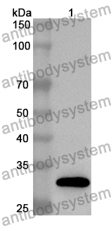 Anti-Human ZNF671 Polyclonal Antibody