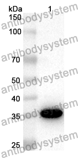 Anti-Human PACSIN2 Polyclonal Antibody