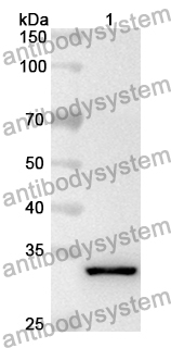 Anti-Human TMEM165 Polyclonal Antibody