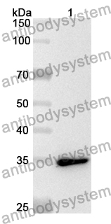 Anti-Human TRPS1 Polyclonal Antibody