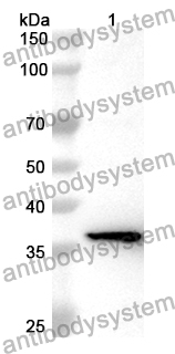 Anti-Human ZHX2 Polyclonal Antibody