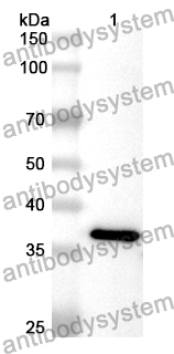 Anti-Human SLC32A1 Polyclonal Antibody