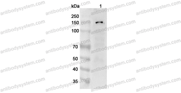 Anti-Human ANO1 Polyclonal Antibody