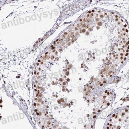 Immunohistochemical for Anti-Human SUPT16H Polyclonal Antibody ?>