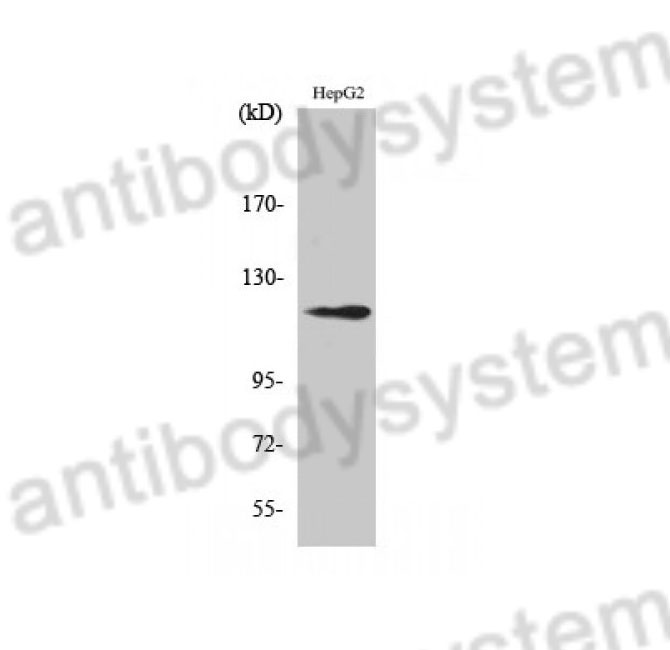 Western Blot for Anti-Human SUPT16H Polyclonal Antibody ?>