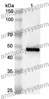 Anti-Human SUPT16H Polyclonal Antibody