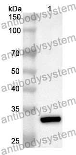 Anti-Human TOMM22 Polyclonal Antibody