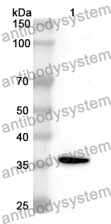 Anti-Human NRSN2 Polyclonal Antibody