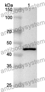 Anti-Human BORCS5 Polyclonal Antibody