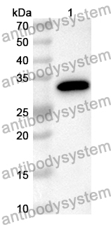 Anti-Human CDCA2 Polyclonal Antibody