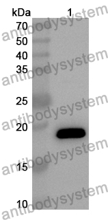 Anti-Human RANBP9 Polyclonal Antibody