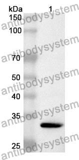 Anti-Human MTHFD1L Polyclonal Antibody