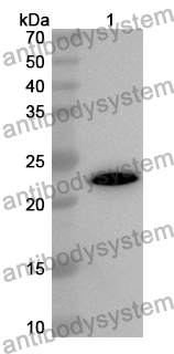 Anti-Human MICOS13 Polyclonal Antibody