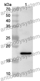 Anti-Human CREB3L2 Polyclonal Antibody