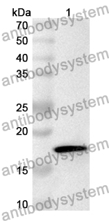 Anti-Human ARID3A Polyclonal Antibody